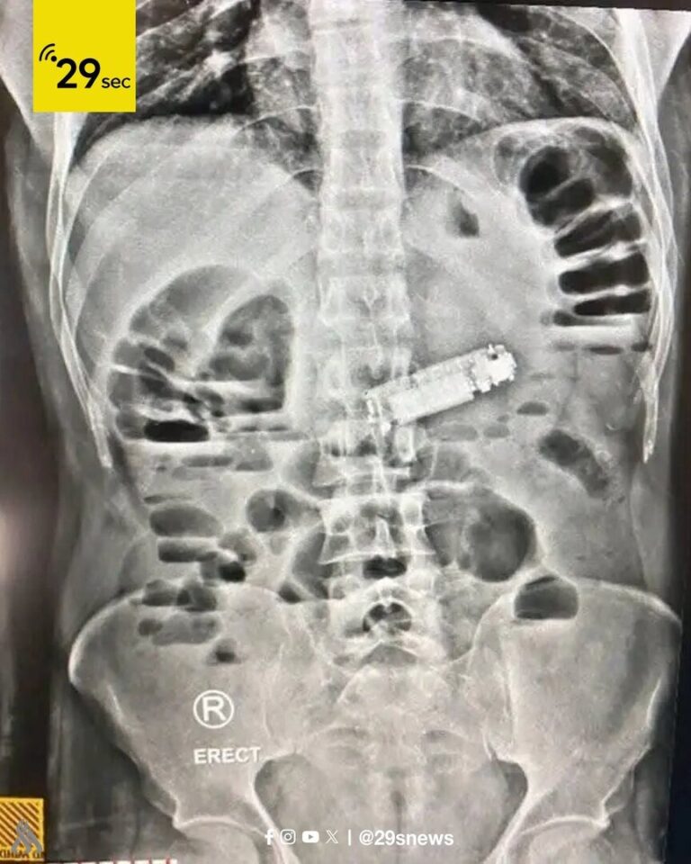 689aeb344c59b7261631aff6